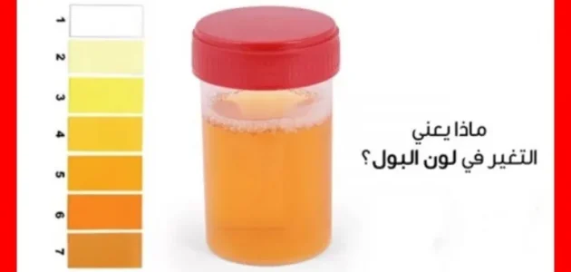 تفسير حلم رؤية تغير لون البول في المنام وعلاقته بالرزق الوفير 1 تفسير تغير لون البول في المنام