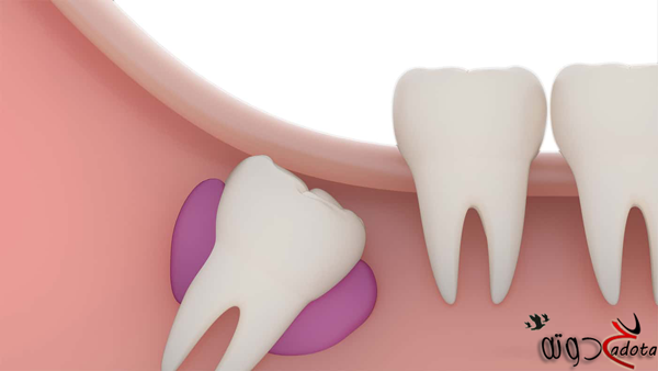 ما تفسير رؤية ظهور سن جديد في المنام