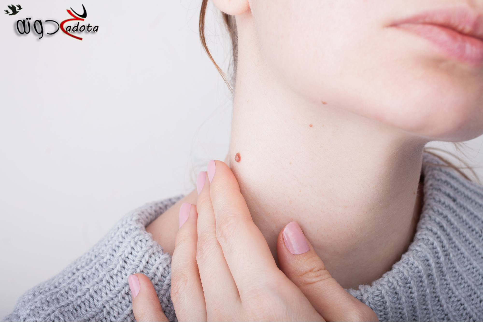 تفسير رؤية الثالول في المنام