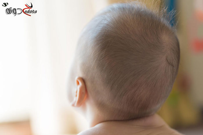 تفسير رؤية جرح الرأس في المنام