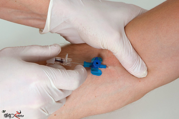 تفسير رؤية الكانيولا في المنام