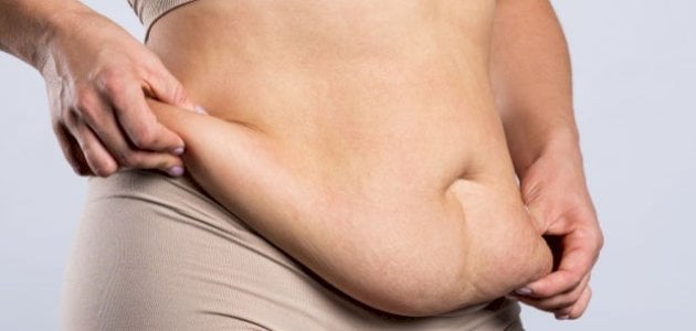 تفسير رؤية البطن المترهل في المنام