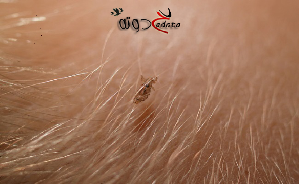 تفسير رؤية القمل في شعر رأس شخص آخر في المنام