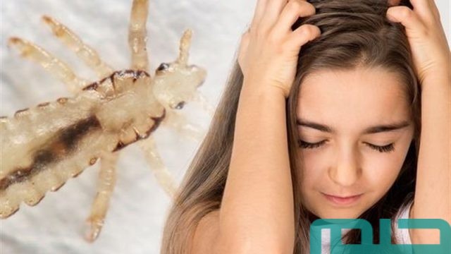 حلم القمل في الشعر